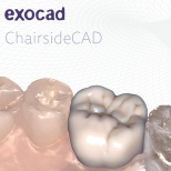 exocad ChairsideCAD