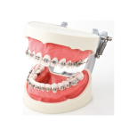 Ortodontyczny model demonstracyjny